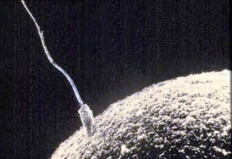 https://www.z3xmi.it/get image/spermatozoo web https://www.z3xmi.it/get image/spermatozoo web
