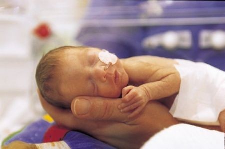 parto pretermine e cura dei bambini prematuri