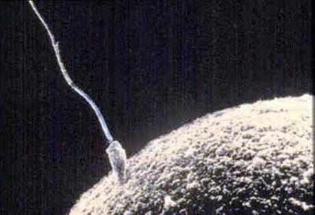 spermatozoo web